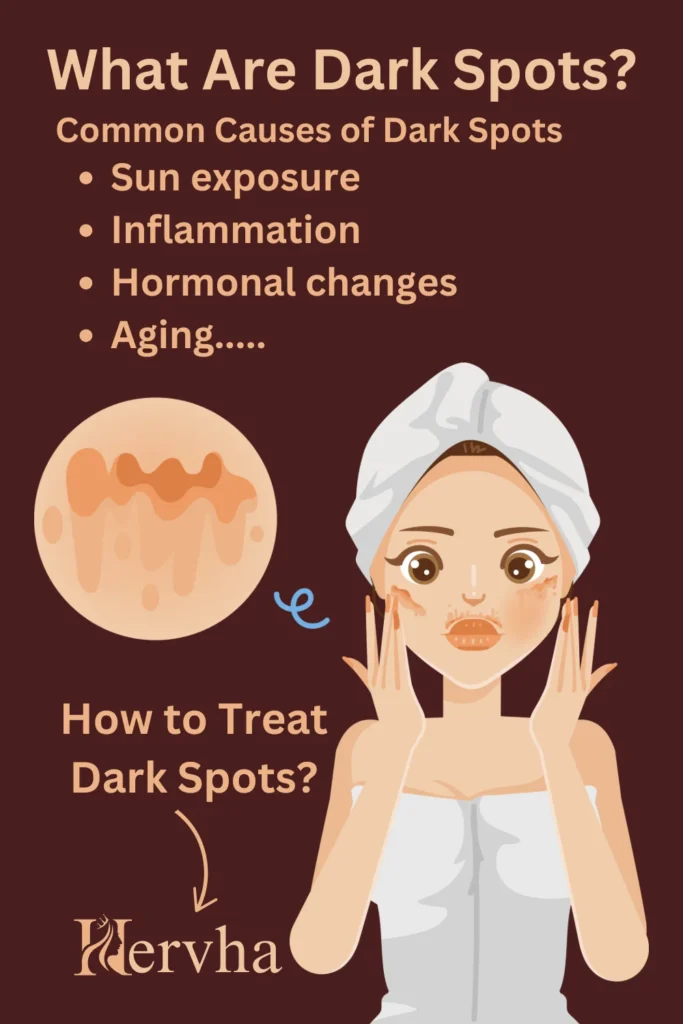 What Are Dark Spots, Causes and treatment