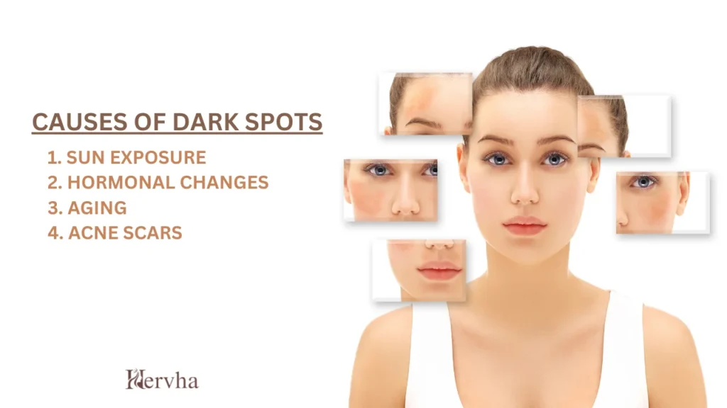 Causes of Dark Spots